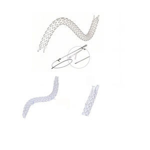 Ureter-Stent