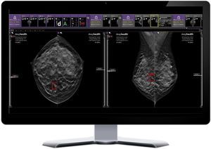 KI-Plattform für Krankenhaus