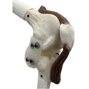 Knie-Phantom