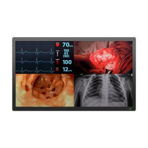 medizinisch Monitor