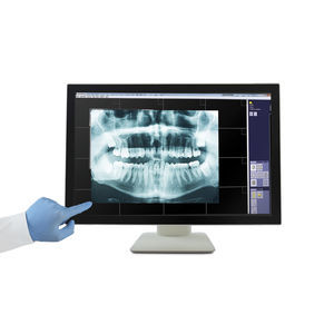 medizinisch Monitor 1