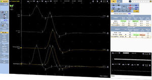Software für EMG 1