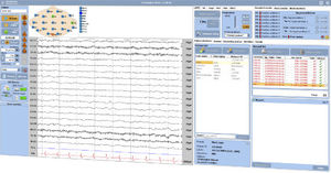 EEG-Software 1