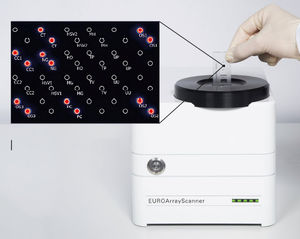 Testkit für Geschlechtskrankheiten / Mycoplasma / Ureaplasma urealyticum / Neisseria gonorrhea