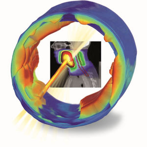 Software für Strahlentherapie