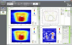 Software für Strahlentherapie