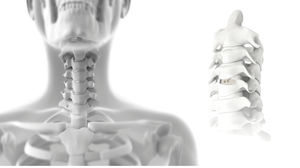 HWS-Zwischenwirbelimplantat