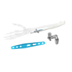 Kompressionsplatte für Ulna