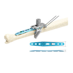 Osteotomieplatte für Ulna