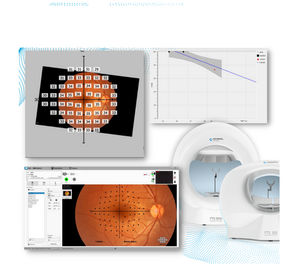 Software für Ophthalmologie