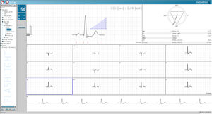 Software für EKG