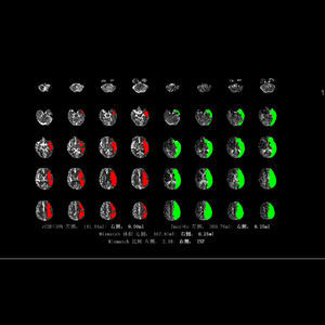 Diagnose-Software 1