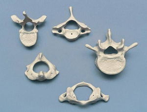 Anatomisches Modell / Halswirbel 1