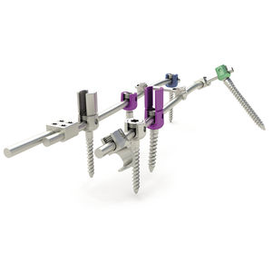 thorako-lumbales Stabilisierungssystem für Osteosynthese 1
