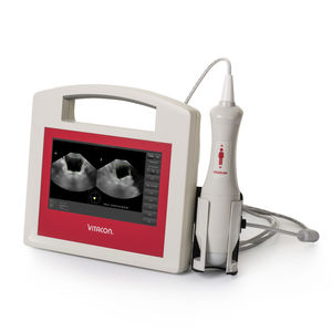 tragbarer Blasenscanner 1