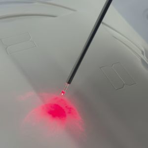 Lichtwellenleiter für chirurgischen Laser