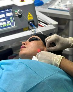 Hautverjüngungseinheit mit Laser 1