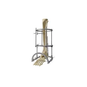 Fixateur externe / für Tibia 1