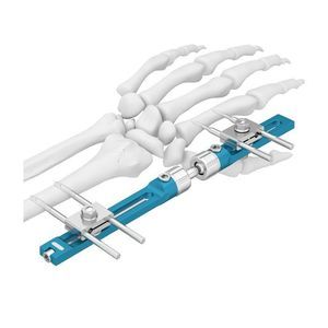 Fixateur externe / für Handgelenk 1