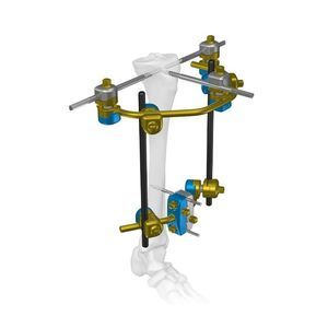 Fixateur externe / für Tibia 1