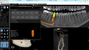 Management-Software / 3D-Visualisierung / Diagnose / Behandlungsplanung