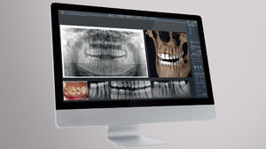 Software für dentale Bildgebung