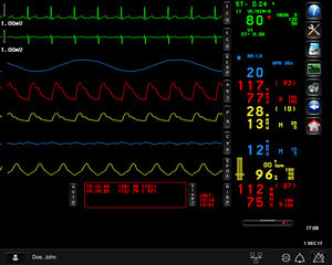 Monitoring-Software