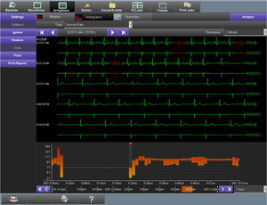 Software für EKG