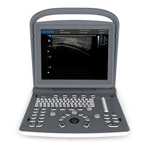 tragbares Ultraschallgerät 1