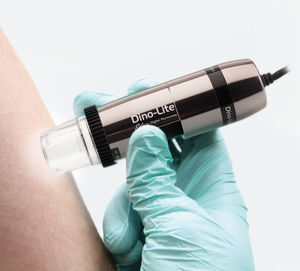 Videodermatoskop