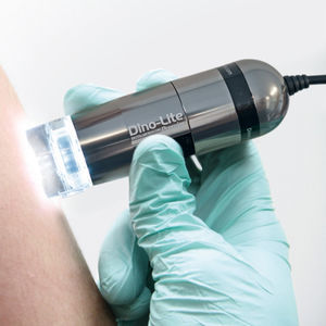 Videodermatoskop