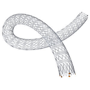 peripherer Stent 1
