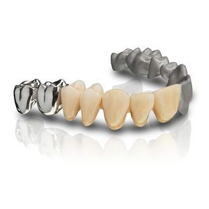 Zahnmedizinisches Material / Metall 1