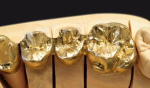 Zahnmedizinisches Material / Metall 1