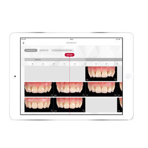 IOS-Applikation / Dental