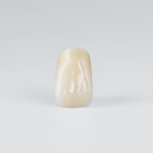 PMMA-Zahnprothese 1