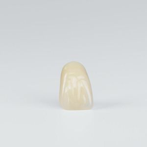 Acrylzahnprothese 1