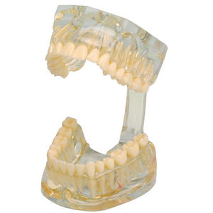 Anatomisches Modell / Gebiss / für Ausbildung / transparent