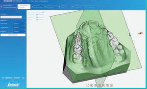 Software für Dentallabor