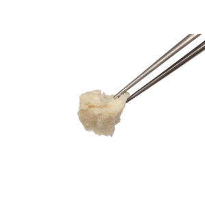Allograft-Knochenersatzmaterial 1