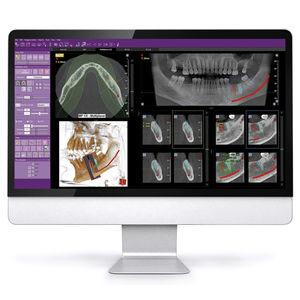 Software für dentale Bildgebung