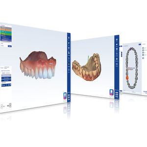 Software für Zahnprothese-Design