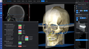 orthodontische Software