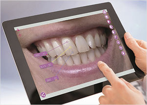 Software für Dentallabor