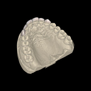 Software-Modul / für Dentallabor