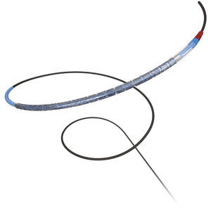 Koronararterien-Stent 1