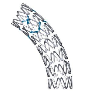 Koronararterien-Stent 1