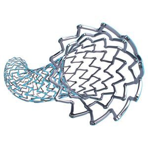 Koronararterien-Stent 1
