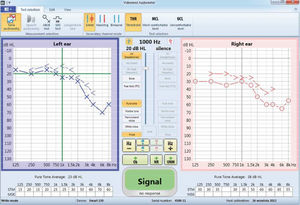 Audiometriesoftware