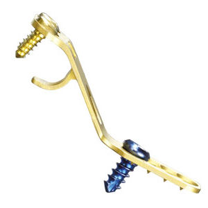 Knochen-Kompressionsplatte / Laminoplastie